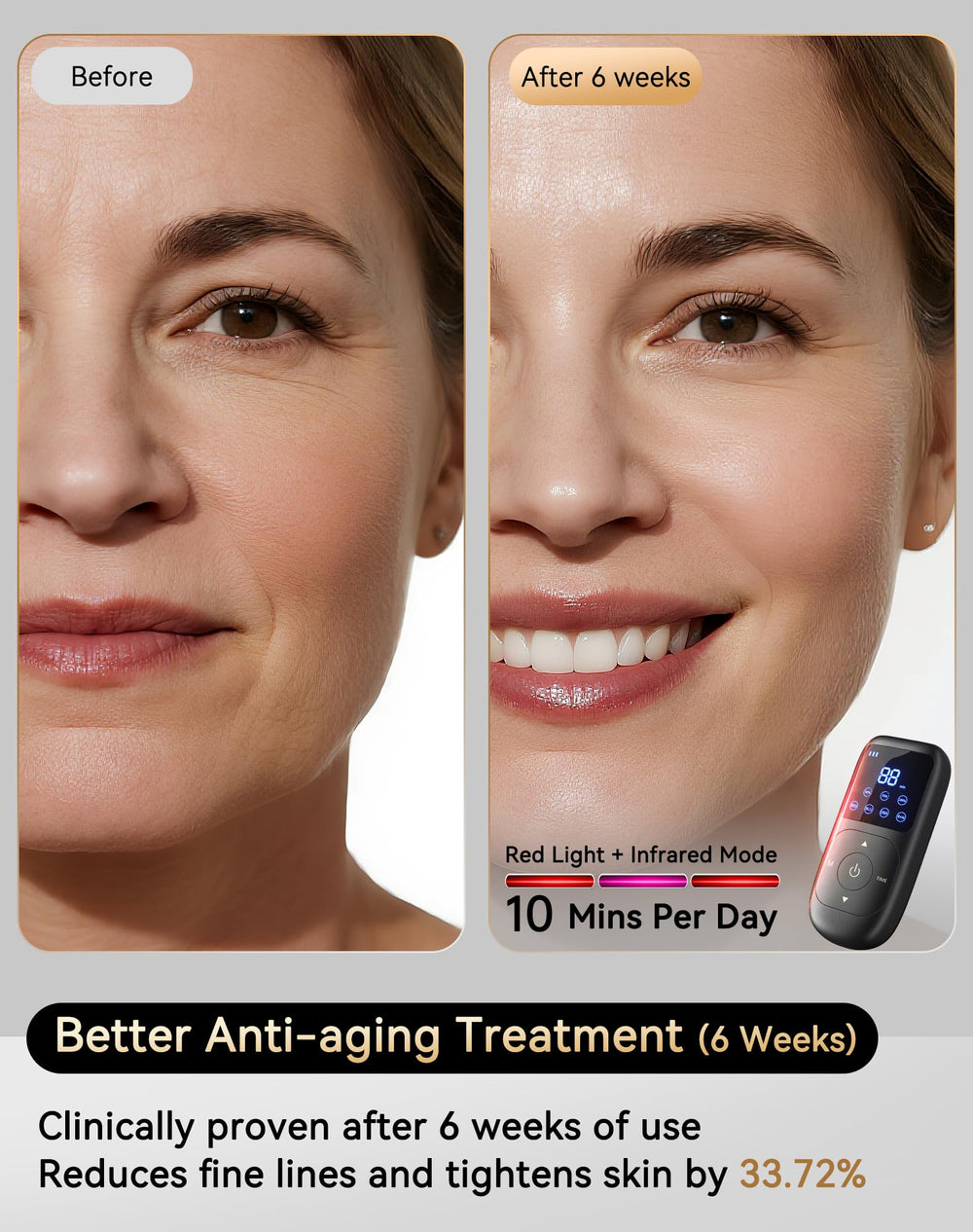 Sobetuar 4D red light mask close-up around eyes and cheeks for targeted treatment.