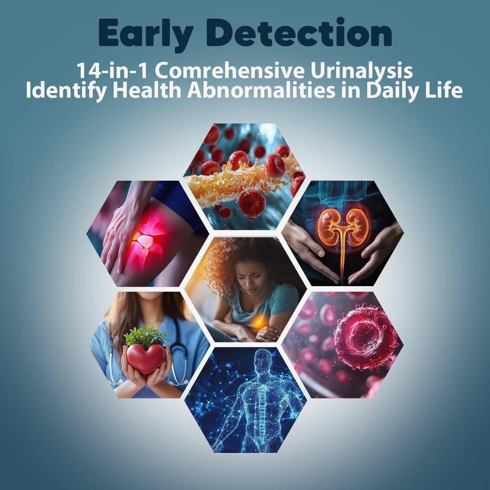 Spehomy-Test URS color chart aids rapid result interpretation.