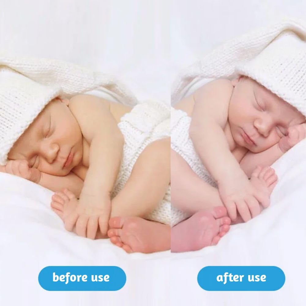Stickfrease portable light therapy device fits travel and home