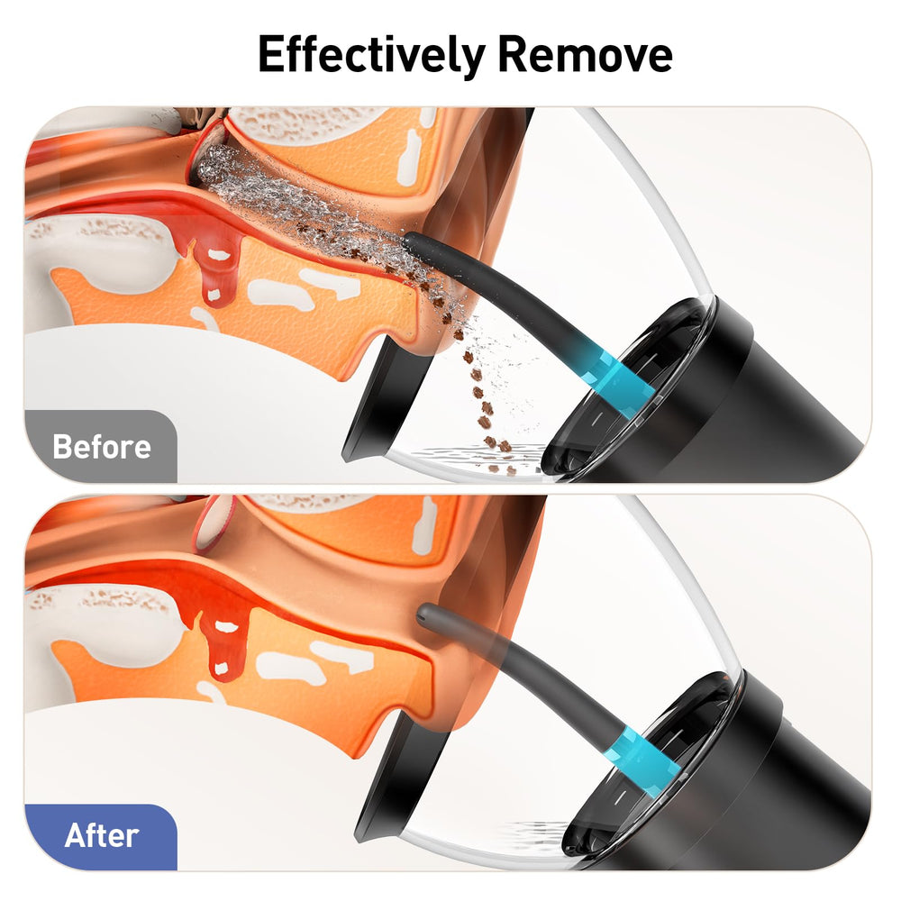 STYNGT ear wax removal with IPX6 waterproof design ideal for bathroom use