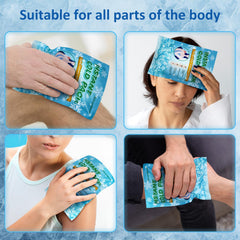 SuccorWare large 5.9 by 8.6 inch cold pack covers bigger areas.