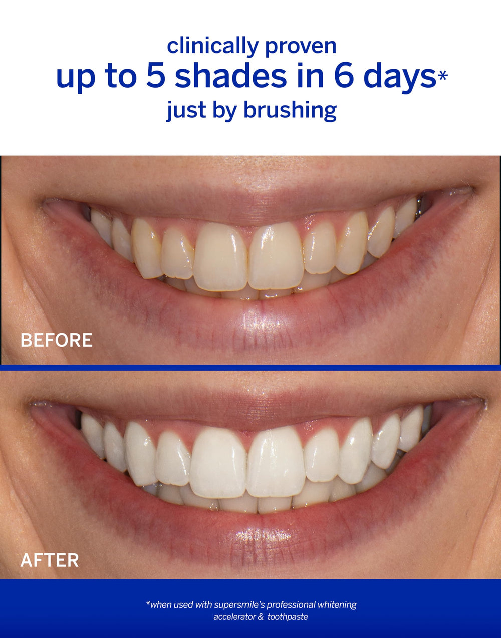 Supersmile Rosewater Mint whitening system accelerator highlights the whitening booster in action.