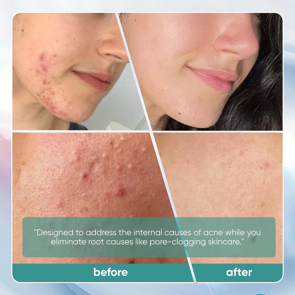 SUUDUUL DIM hormonal balance ingredient close-up suggesting clearer skin potential