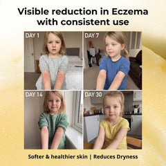 Sven's Island Miracle Manuka balm texture shows a rich, easy-to-spread ointment.