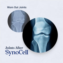 Synocell movement illustration highlights flexible joints.