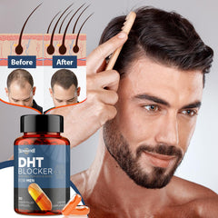 Talyvoriathor DHT Blocker packaging, premium quality and purity.