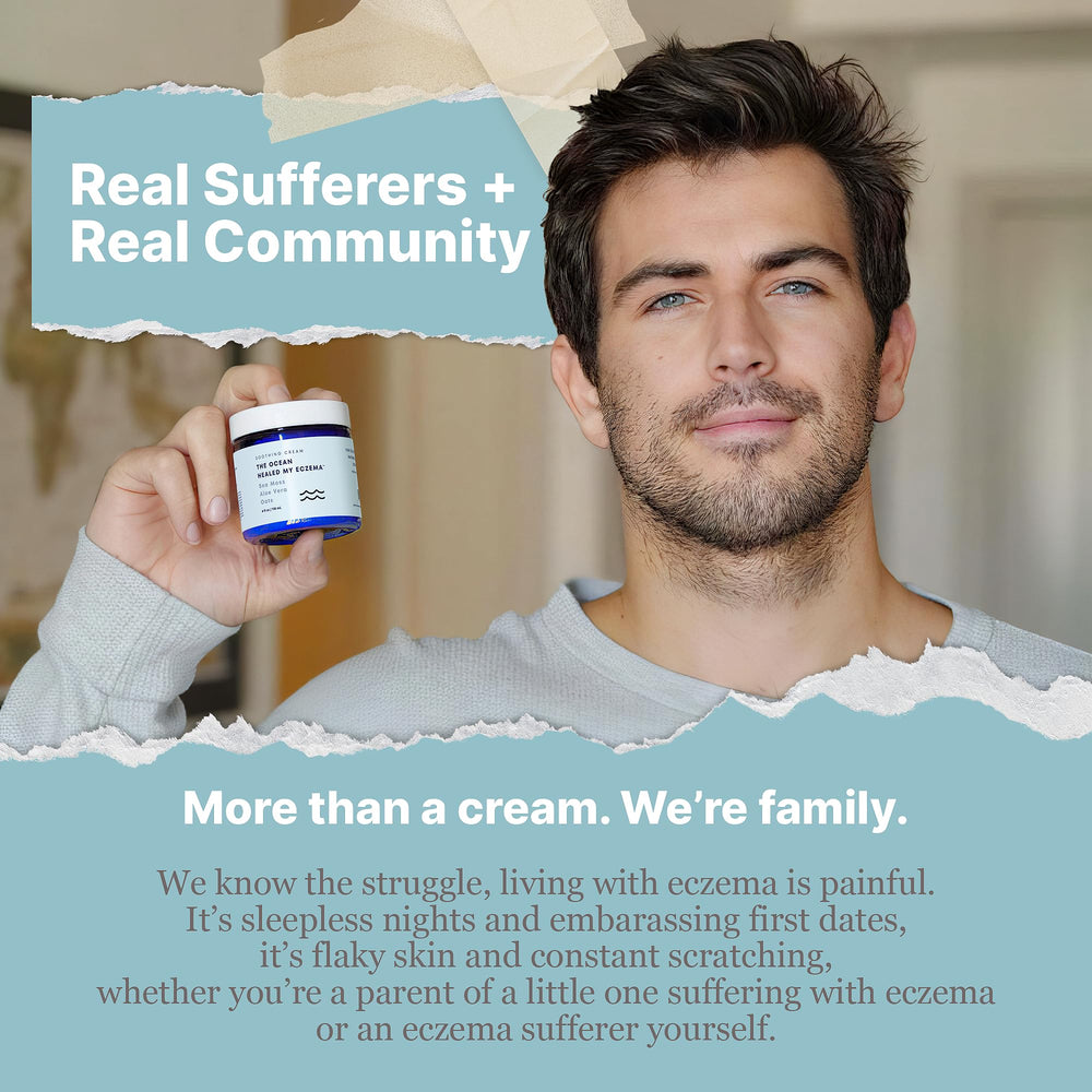 Targeted spot use of The Ocean Healed My Eczema cream