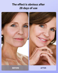 Tinkoola travel-ready mask for on-the-go LED sessions.