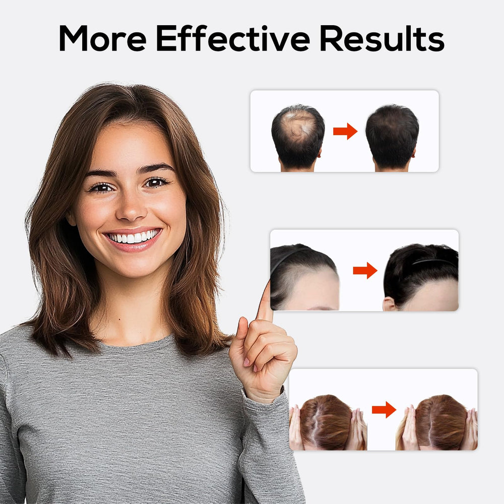 TMOSSO Laser Cap packaging highlights the 16-week routine.