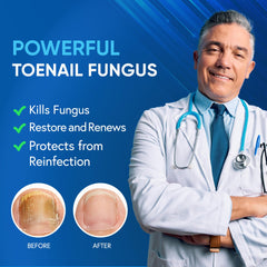 Tobcharm 25 percent undecylenic acid formula label supports targeted care