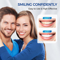 Toos Show Included Items help you prepare for whitening at home.