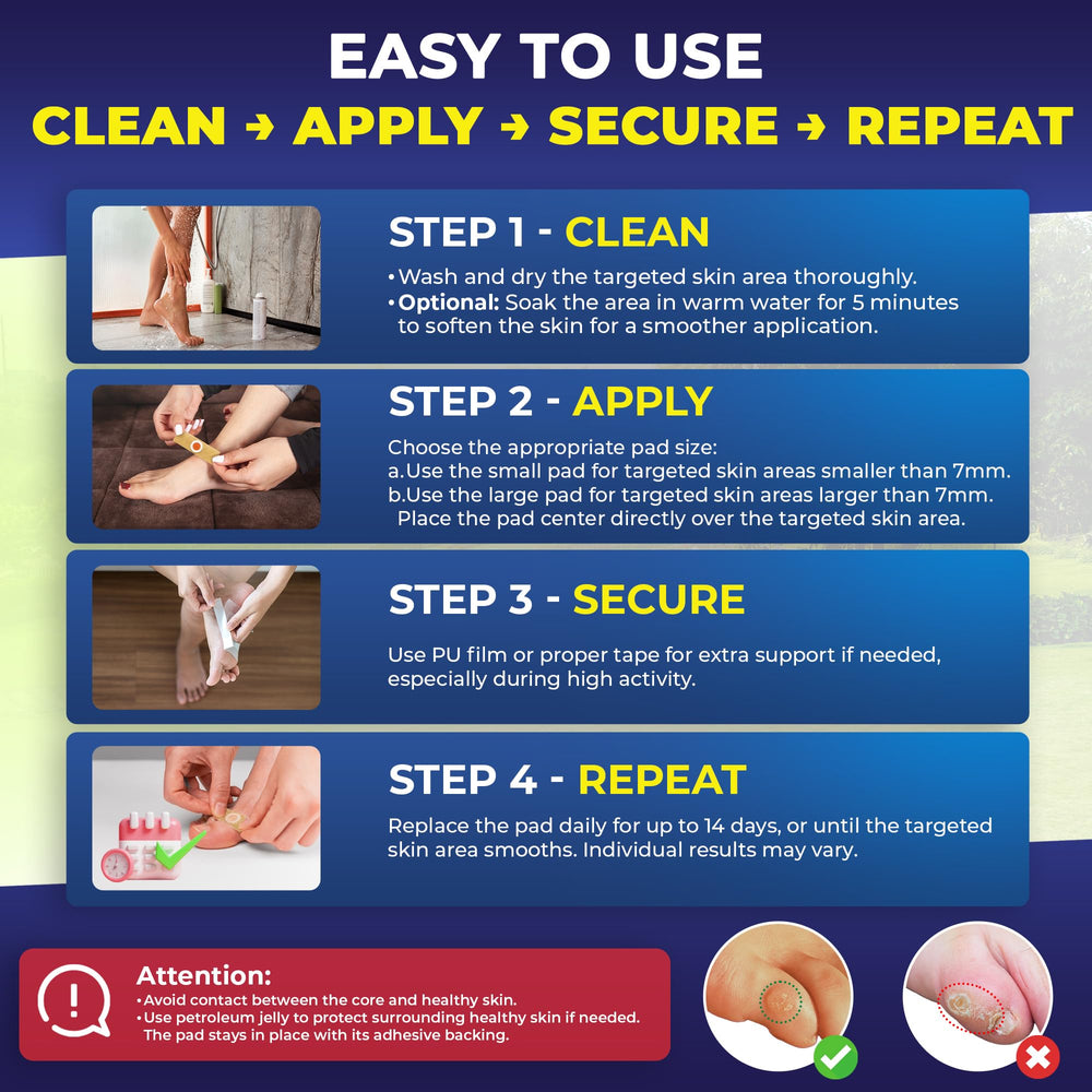 Ulensy pad placed on the sole to ease walking discomfort