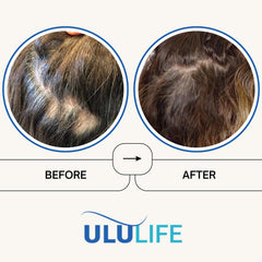 ULULIFE Ultimate Regrow bottle pour suggesting easy daily use