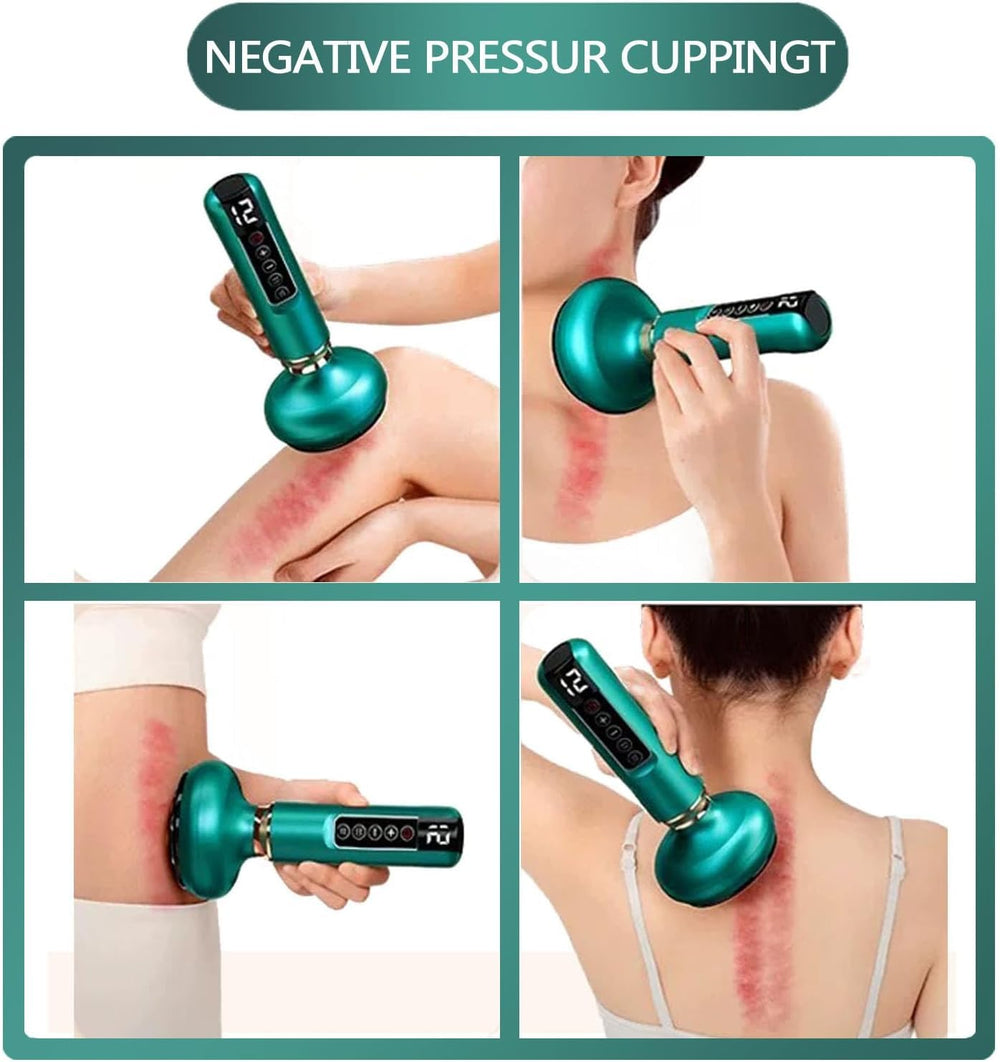 Uojojop one-button air release emphasized for painless cupping.