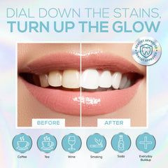 Venus Visage two mouth trays fitting a range of mouth sizes for comfort
