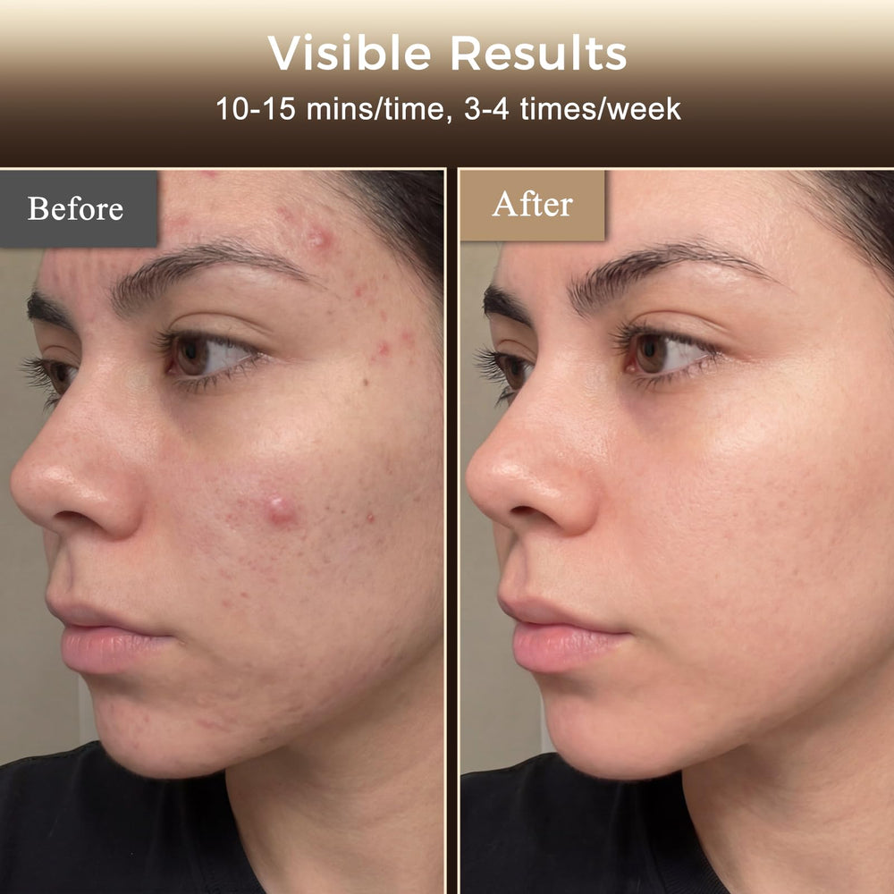 Verfubo neck attachment extends coverage for neck treatment