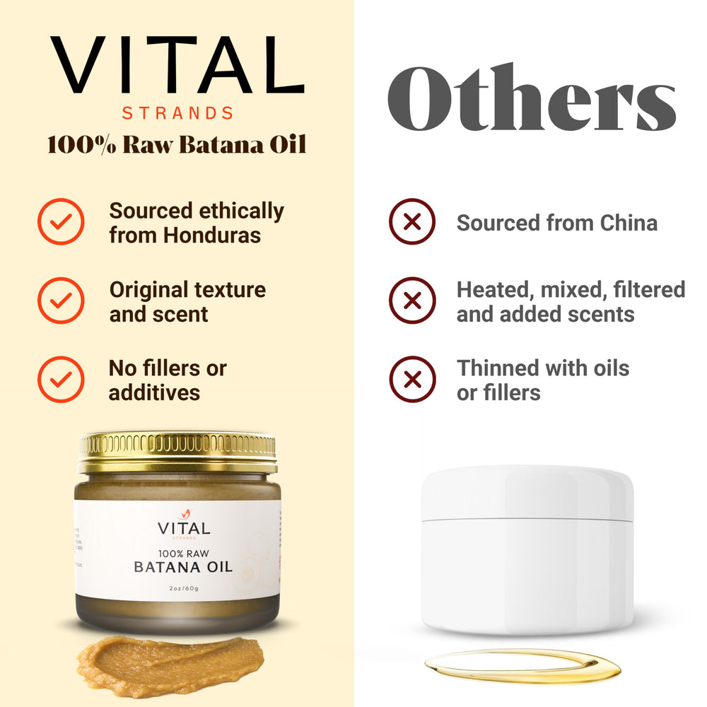 Vital Strands Batana: detox del cuero cabelludo y alivio de picor.
