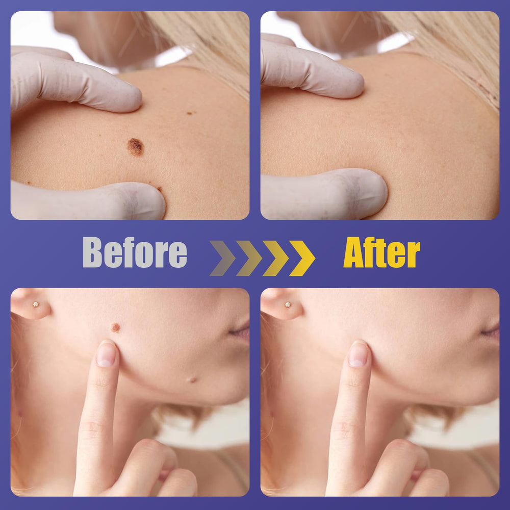 Thin, discreet WABRINY patch blends with skin for confident wear.
