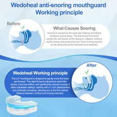 Wedoheal snoring mouthpiece with travel case for on-the-go relief