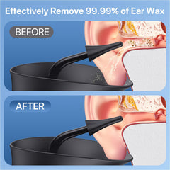 Wisdagaly ear cleaner with a temperature sensor for safe water temperature.