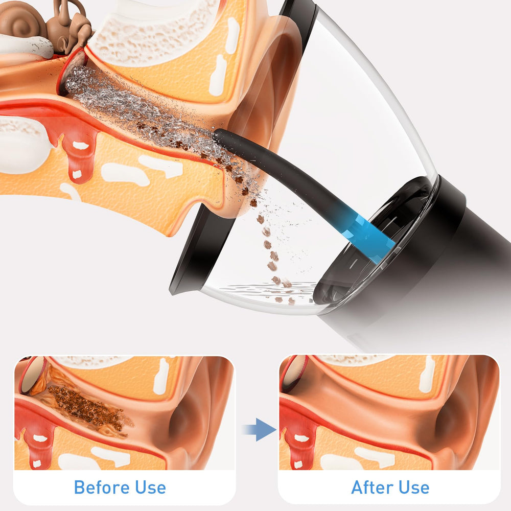 Yakbio waterproof ear irrigator with IPX6 rating for shower-safe ear care.