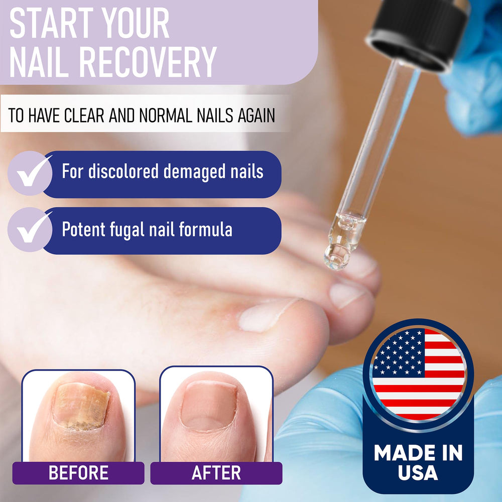ZanaQuick nail recovery drops closeup with precision applicator.