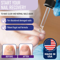 ZanaQuick nail recovery drops closeup with precision applicator.