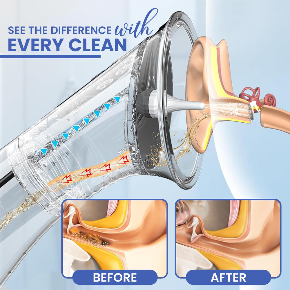 ZEYORA complete ear care kit with soft tips for family use.
