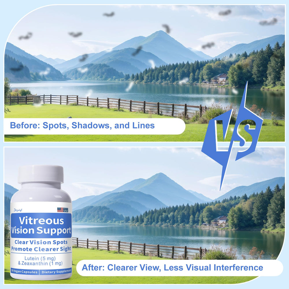 Zhizaiql Eye Vitamin packaging displays 90 vegan capsules for ongoing eye support.