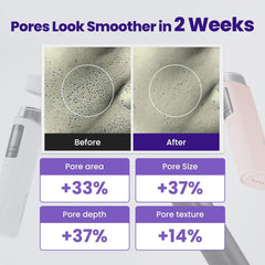 ZIOSTAND Resnovae Core Impact Beauty Massager used on face and neck area.