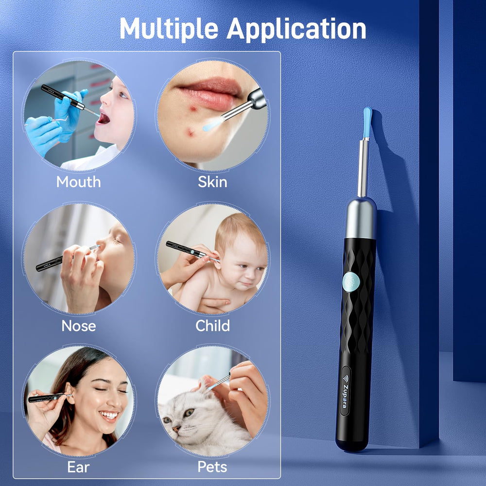 Zupora WiFi otoscope connects offline for privacy