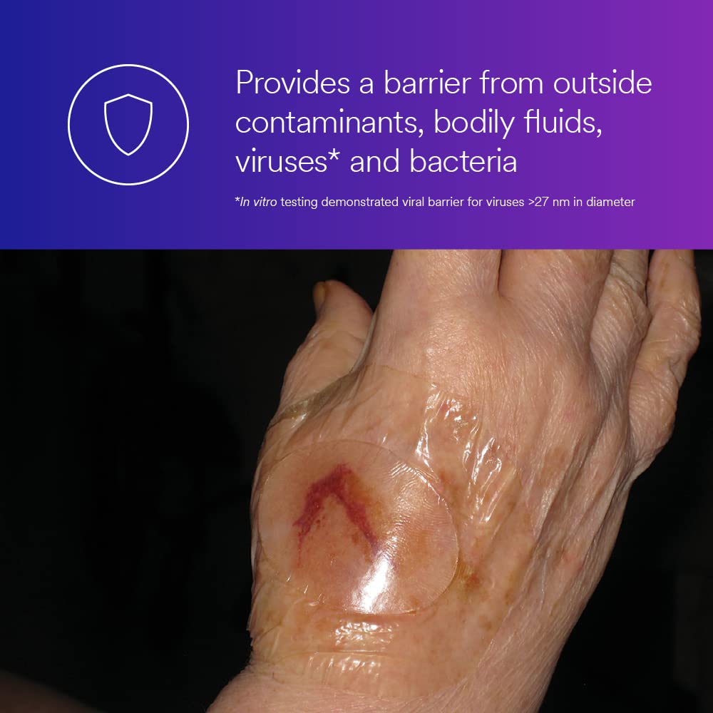 Transparent film layer of 3M Tegaderm Absorbent Clear Acrylic Dressing enables monitoring without removal