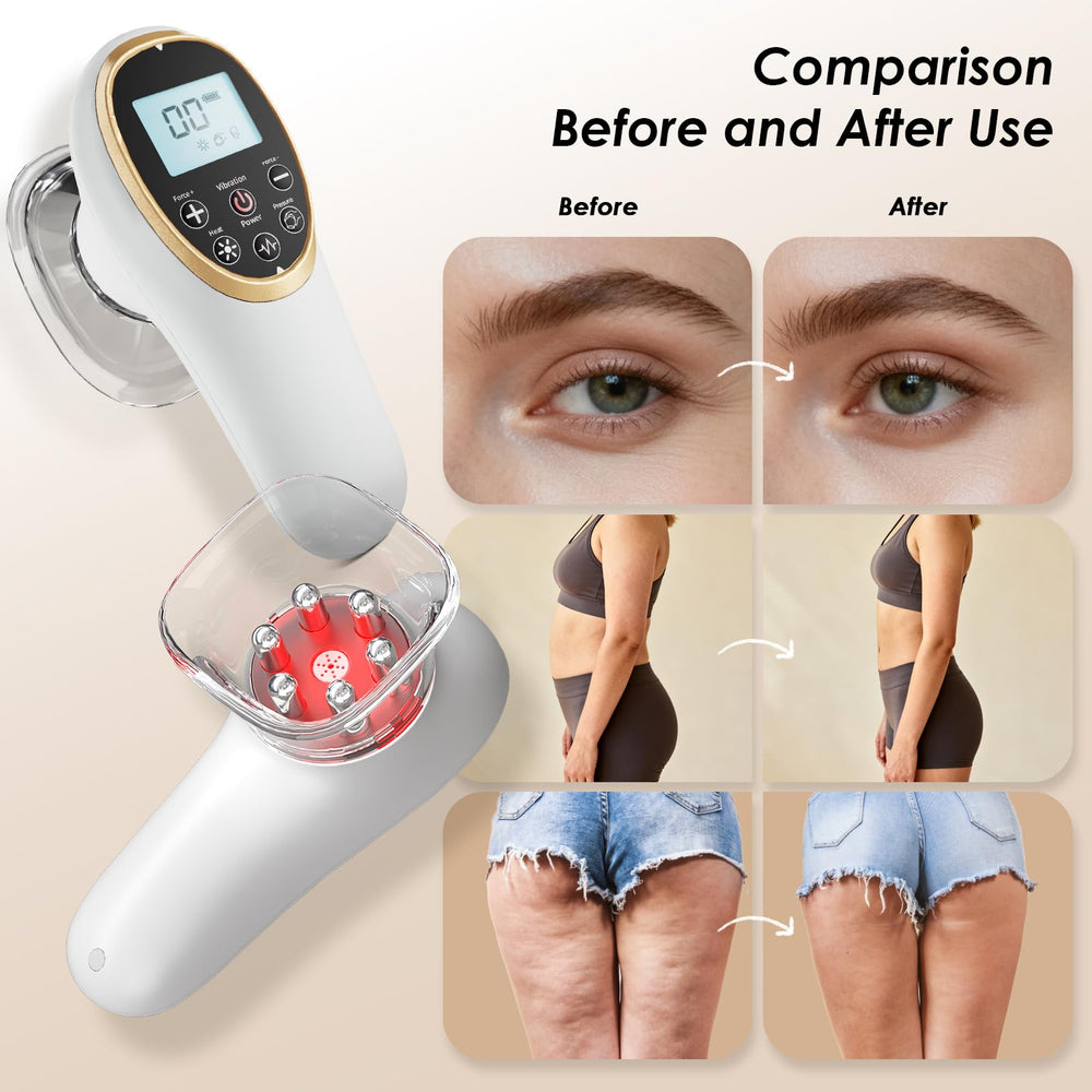 AAQ facial work setup with cups removed for precise tightening