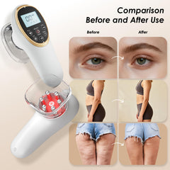 AAQ facial work setup with cups removed for precise tightening