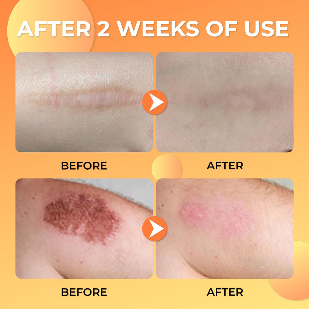 Skin texture after using ABERA Scar Removal Cream showing improved smoothness