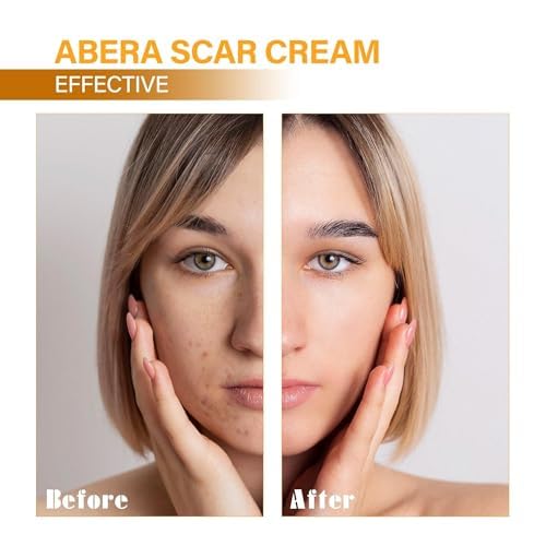 Fragrance-free ABERA formula designed for sensitive skin comfort