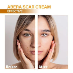 Fragrance-free ABERA formula designed for sensitive skin comfort