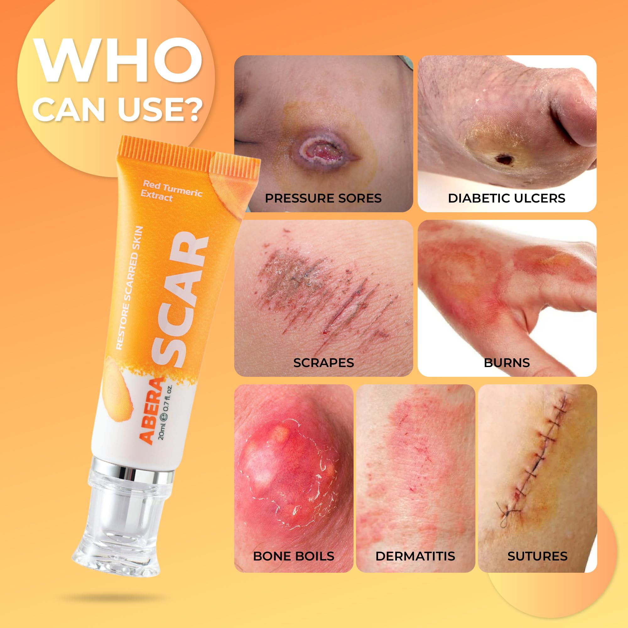 Close-up of ABERA Scar Removal Cream texture showing lightweight, non-greasy finish