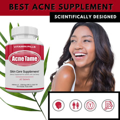 Acnetame Acne Tame capsules closeup, easy-to-swallow daily tablets.
