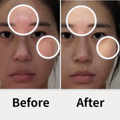 AD SOLUTION ATO patch on cheek demonstrates targeted soothing for irritated skin.