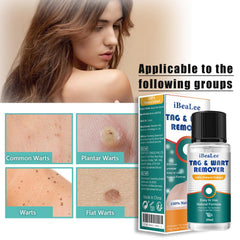 AEDNX Wart Remover liquid drops on the wart promote gentle, daily use.