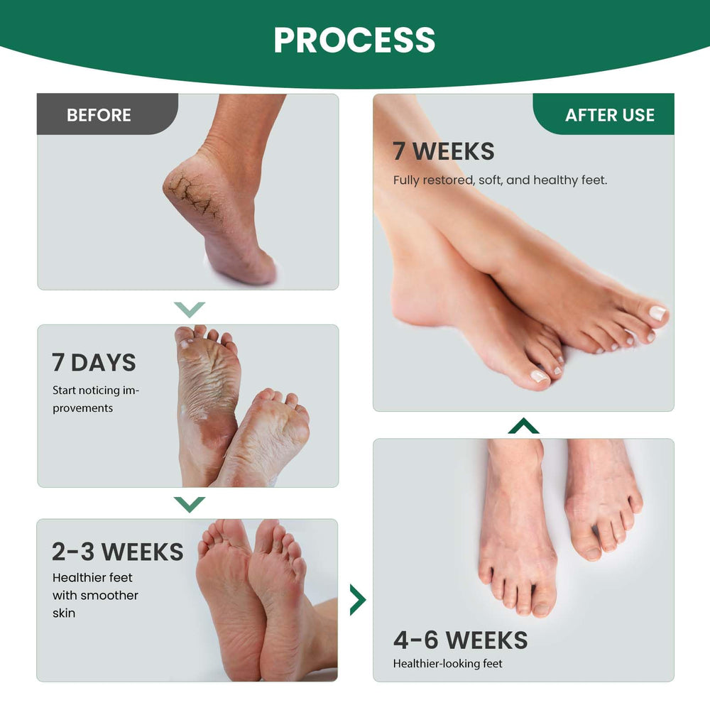 AIFUFAND 7 Days Ginger Foot Spray mist spraying for quick absorption