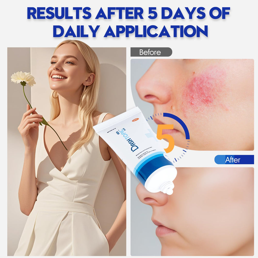 AIM Medical Eczema Relief Cream applied on elbows or knees for dry-prone areas