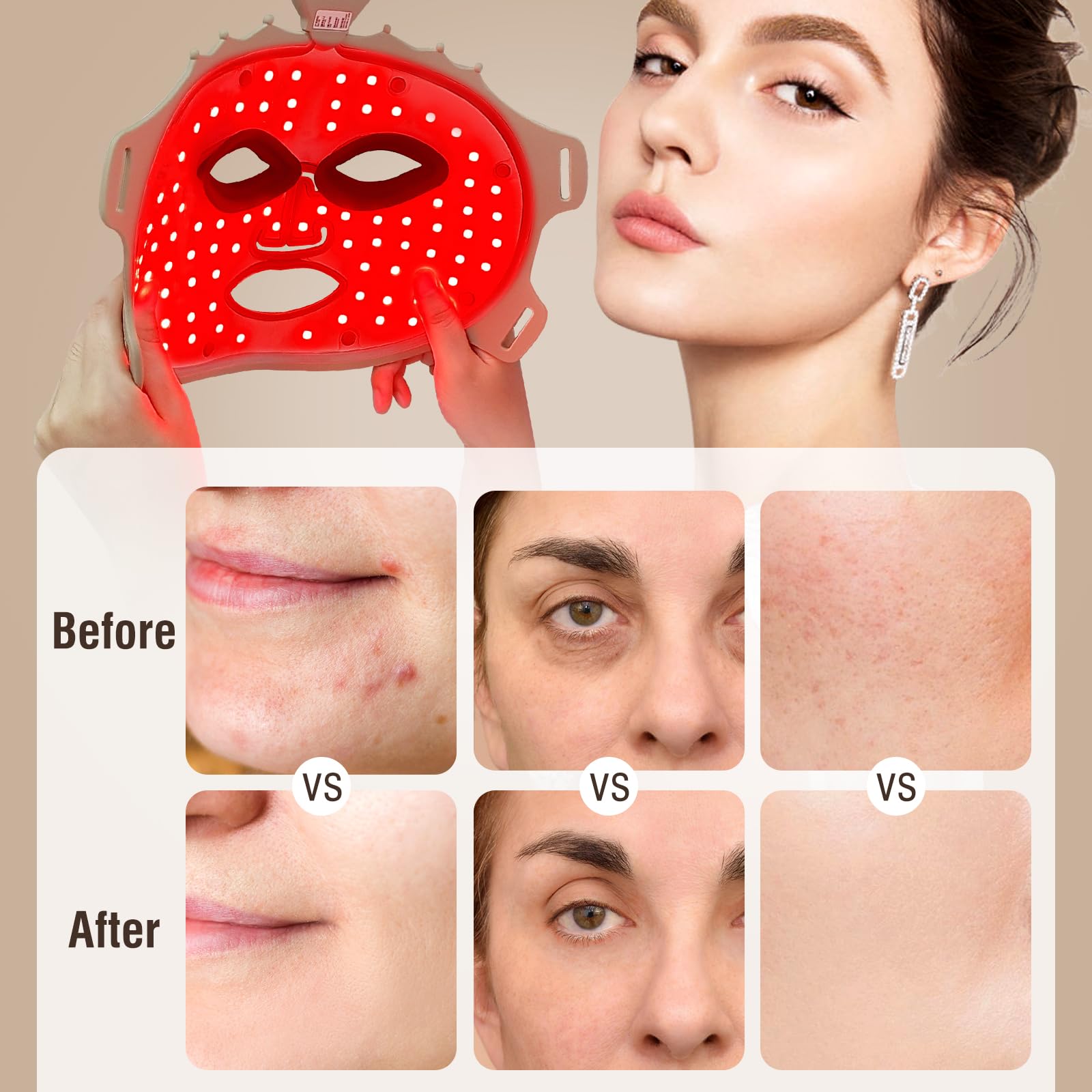 ANGAUSS face mask light therapy side view highlighting cordless design