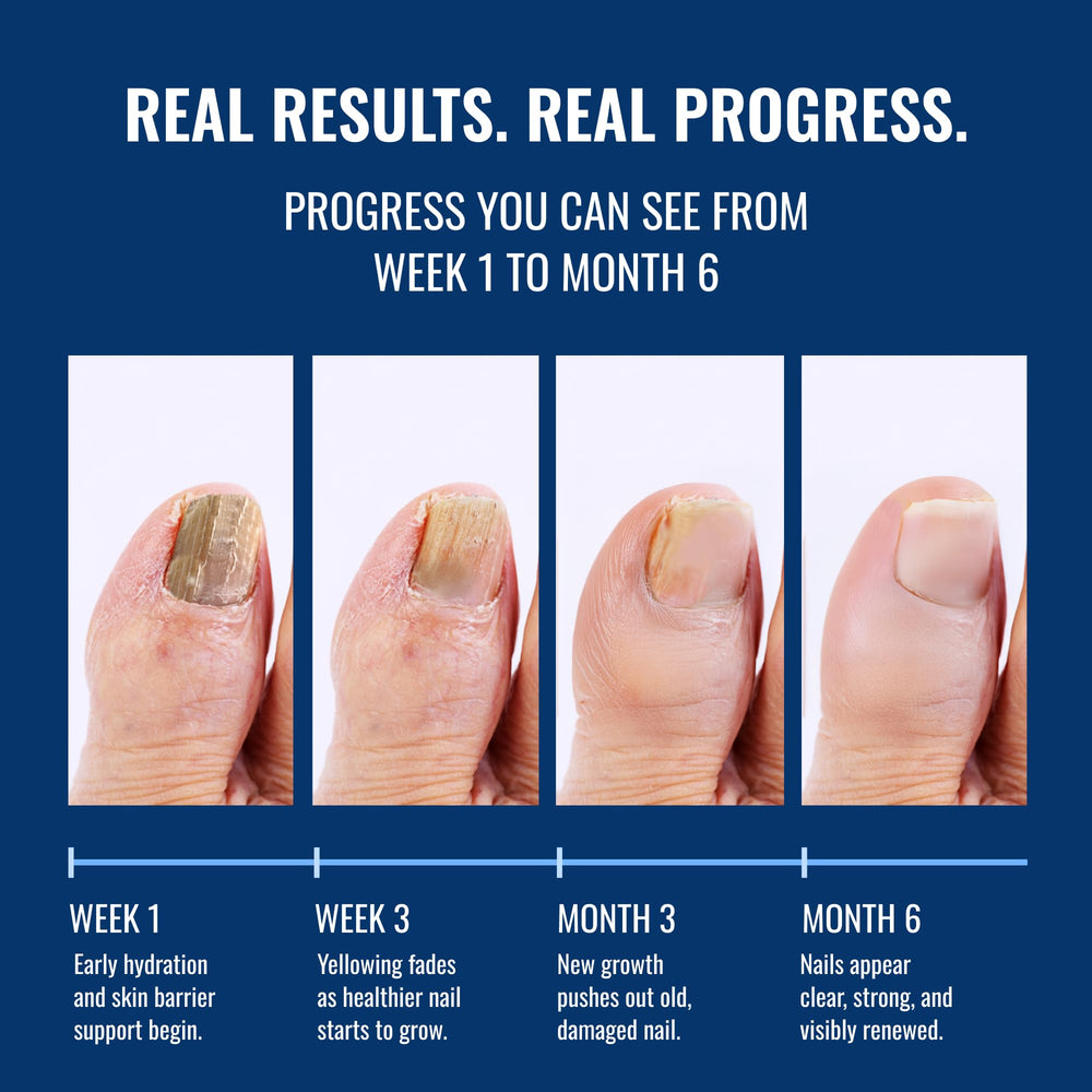 Approved Science Fungix Lavender essential oil infusion adds gentle scent for nail care.