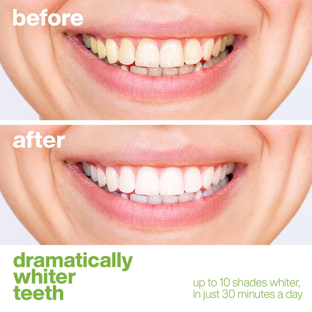 Aquasonic individually wrapped foils keep treatments fresh for on-the-go whitening.