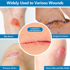 ASKIZ non-adherent gauze patch providing gentle wound protection.