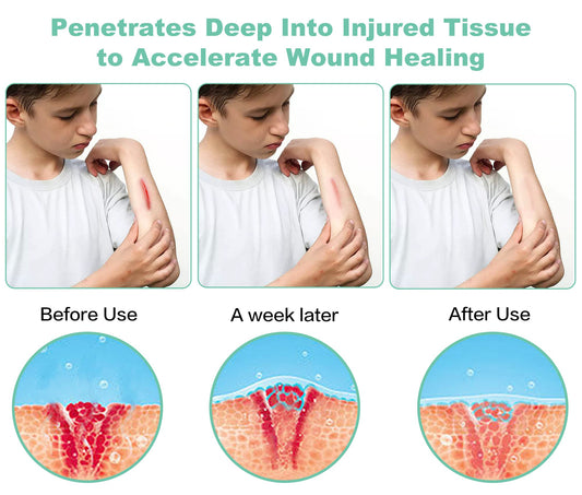 Aswaysun portable handheld design for targeted treatment on knees, wrists, and shoulders.