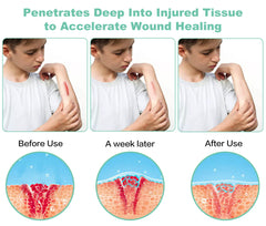 Aswaysun portable handheld design for targeted treatment on knees, wrists, and shoulders.