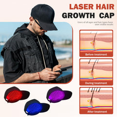 Auarwood LLLT Cap worn on head for comfortable daily use.